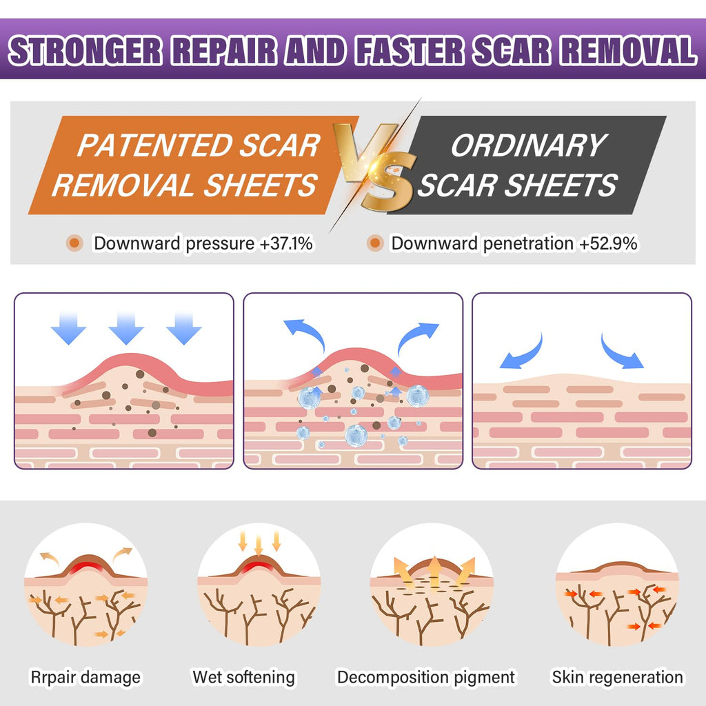 Silicone Scar Sheets, Medical Grade Silicone Scar Tape for Surgical, Hypertrophic, Keloid, C-Section, Burn, Old & New Scars, Reusable Professional Scars Removal Sheets (1.6"X 120" Roll-3M)