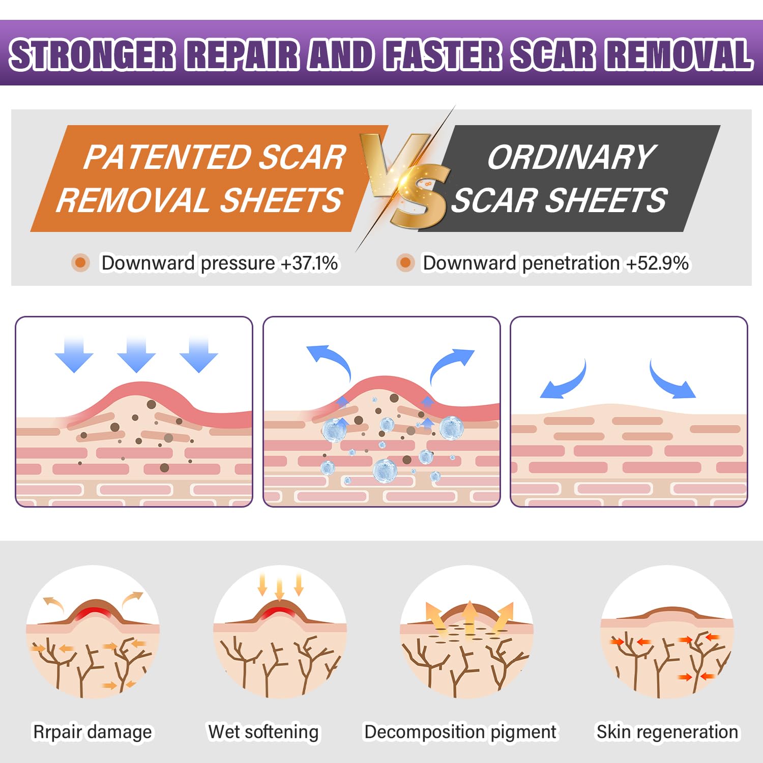 Silicone Scar Sheets, Medical Grade Silicone Scar Tape for Surgical, Hypertrophic, Keloid, C-Section, Burn, Old & New Scars, Reusable Professional Scars Removal Sheets (1.6"X 120" Roll-3M)