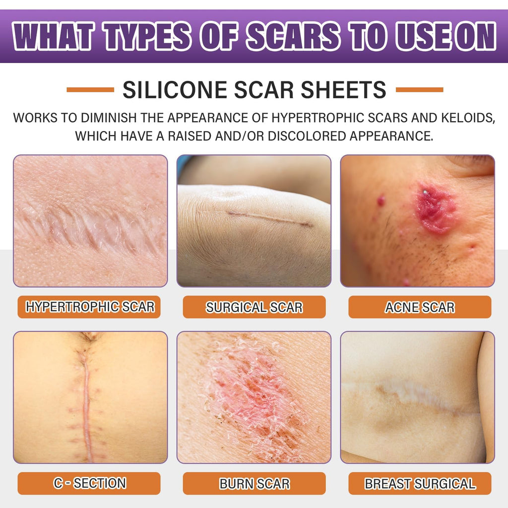 Medical-Grade Silicone Scar Sheets - Reduce Surgical Scars from Cancer Treatment (Reusable)