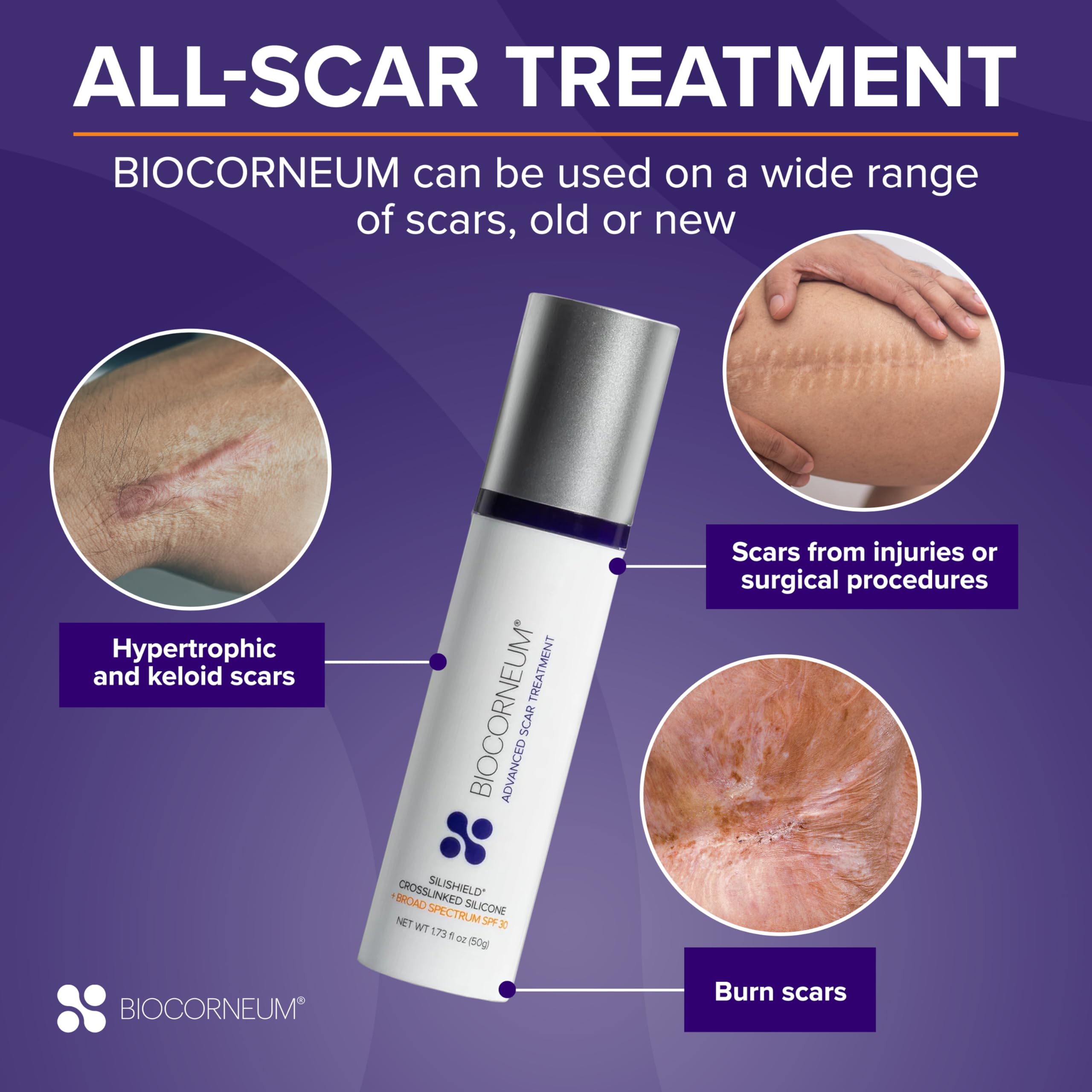 Advanced Scar Treatment with Silishield® & SPF 30 10g – Made in the USA, Fast-Drying, Water-Resistant Silicone Scar Gel - Surgeon Recommended for New & Old Scars - Suitable for Children Over 6 Months
